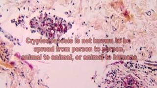 Cryptococcus Fungi The Cause of Cryptococcosis [upl. by Noyart233]