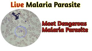 malaria trophozoites under microscope  malaria under microscope  Tanu Path [upl. by Dott796]