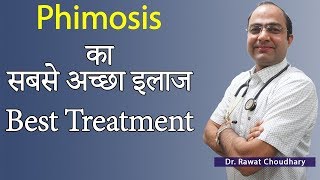 Phimosis का बिना ऑपरेशन के इलाज  Best Treatment of Phimosis  Best Homeopathic Doctor in India [upl. by Nair]