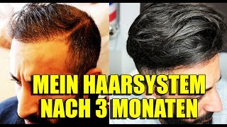 MEIN HAARSYSTEM NACH 3 MONATEN  VOLLE HAARE OHNE OP  BARTMANN [upl. by Algar]