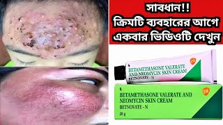 Betnovate n skin cream  বেটনোভেট এন ক্রিম এর কাজ কি ত্বক ফর্সাকারী ক্রিম  Betnovate N Cream [upl. by Henrique955]