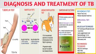 Diagnosis and treatment of Mycobacterium TB  Tuberculin mantoux test  Medical micro Part3 [upl. by Barling856]