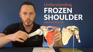 Understanding FROZEN SHOULDER and how to stretch for greater movement [upl. by Beauchamp]