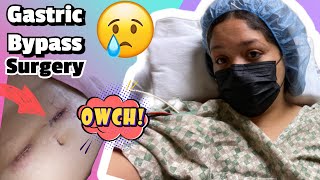 Bariatric SurgeryGastric Bypass I Finally did it [upl. by Codie]