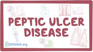 Peptic ulcer disease  causes symptoms diagnosis treatment pathology [upl. by Drarehs]