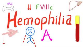 Hemophilia A  Bleeding  Most Comprehensive Explanation  Hematology Bleeding and Coagulation [upl. by Cyrill]