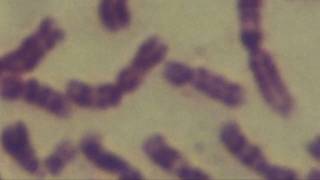 Cytogenetics Human chromosomes Karyotype [upl. by Hengel465]