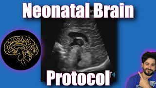 Neonatal Brain Protocol [upl. by Ecnerolf788]