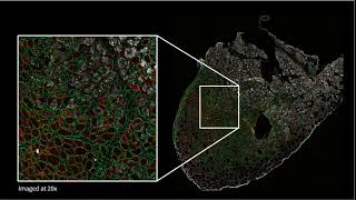 Spatial Proteomic Data with Parallel CITE seq Analysis Elucidates Multiomic Changes with Aging [upl. by Atiroc]