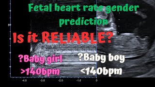 Ultrasound fetal heart rate gender prediction Is it reliable How accurate is it Three Cases [upl. by Rellia59]