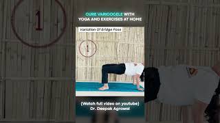 Yoga Aasan for Varicocele at Home  Part 4 varicoceletreatment yogaasanas [upl. by Suzette42]