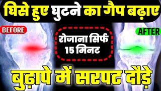 घुटनों का गैप कैसे बढ़ाएंKnee Gap ExercisesOsteoarthritis Knee Exercises [upl. by Dorelle]