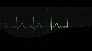 9 hours of Heart rate monitoring EKG grapihics with beeping [upl. by Falda85]