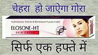 Elosone HT Cream Review Side Effects UsesBest Fairness Cream For Marks [upl. by Haliak]