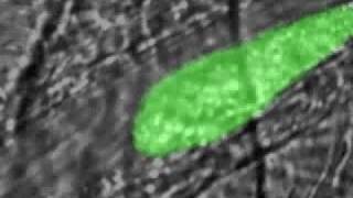 Real time thrombus formation after a laserinduced injury [upl. by Swithbart802]