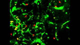 Twophoton microscopy of T cell motility in S1P1GFP mouse lymph node [upl. by Llednik]