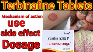 Terbinafine Tablets IP 250mg500mg in hindi Mechanism of action side effects dose [upl. by Amargo]