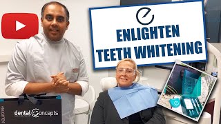 Enlighten Teeth Whitening  Teeth Bleaching  Premium Whitening  Teeth Whitening Demonstration [upl. by Aiksa335]