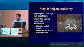 Lumbar Pedicle Screw Placement [upl. by Aryan]