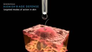 SkinCeuticals Blemish  Age Defense [upl. by Amaryllis]