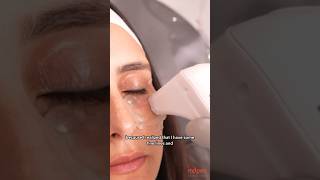 Treat All Eye Concerns With A Single Platform endymed rfmicroneedling [upl. by Olnek]