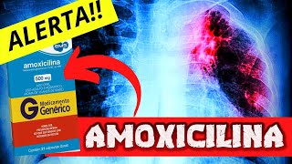 AMOXICILINA 500mg✅✅Alerta sobre a AMOXICILINA 500 mg para que serve Como tomar e Efeitos Colaterais [upl. by Phylis]