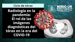 Rx en la pandemia El Rol de las Imágenes diagnósticas del tórax en la era del Covid19  MIRIGUR [upl. by Yoong337]