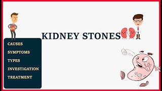 Kidney stone  causes  types  symptoms  treatment [upl. by Jarlen]