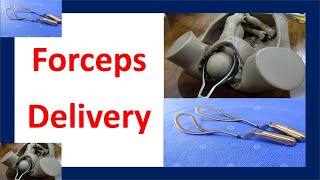 Forceps Delivery  Forceps Assisted Delivery  Delivery with Forceps [upl. by Ailongam]