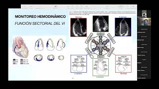 Seminario Imagen Cardiaca Monitoreo hemodinámico por ecocardiografia [upl. by Nylirehc506]