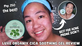 BEST SOOTHING GEL FOR ACNE PRONE SKIN AND SENSITIVE SKIN  LUXE ORGANIX CICA SOOTHING GEL REVIEW [upl. by Campagna]