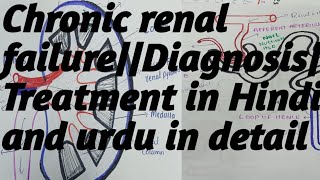 Chronic renal failureDiagnosisTreatment in HindiUrdu in detail [upl. by Aleemaj]