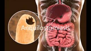 Generalidades y prevención de helmintos Uncinarias y Strongyloides Stercoralis [upl. by Kellene264]