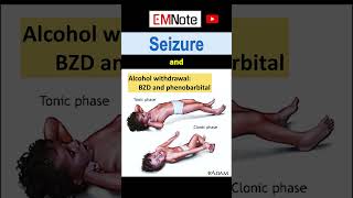 Nontypical Seizures [upl. by Ennyleuqcaj]