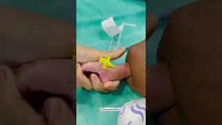 Bandeya 💉🌡️✌️ ivcannulation newbornbaby babydocter ytshorts kidsvideo injection viralvideo [upl. by Emerej]