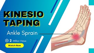 How to treat an Ankle Inversion Sprain  Kinesiology Taping to stabilise ligaments [upl. by Caldeira]