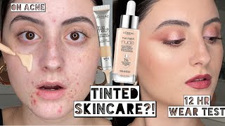 Best Makeup Day LOREAL TINTED HYALURONIC SERUM amp EYECREAM ON ACNE  10 Hour Wear Test [upl. by Harlen]