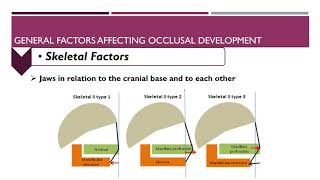 Lec 1 etiology of malocclusion [upl. by Ramraj809]