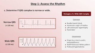 Intro to EKG Interpretation  A Systematic Approach [upl. by Hills]