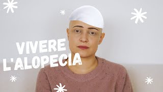 Vivere lAlopecia Areata  La mia storia [upl. by Uokes97]