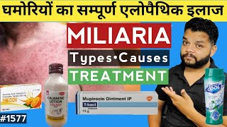 घमोरिओं का कारण और एलोपैथिक इलाज  Miliaria Types Causes amp Treatment [upl. by Susette]