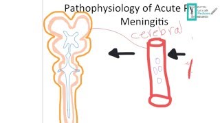 Meningitis Part 1 [upl. by Akialam929]