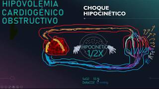 VASOPRESORES E INOTRÓPICOS ¿CUÁL Y CUÁNDO UTILIZARLOS [upl. by Neddy]