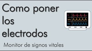 Disposición de los electrodos  monitor de signos vitales  video 1 [upl. by Anala]