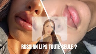 JE FAIS MES INJECTIONS TOUTE SEULE RUSSIAN LIPS [upl. by Mailliwnhoj]