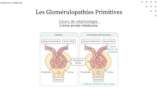 les Glomérulopathies Primitives  LGM HSF GEM maladie de BERGER GNMP GNRP nephro [upl. by Anar]