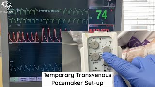 Temporary transvenous pacemeker setup [upl. by Timmie]