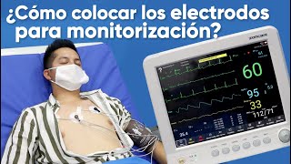 ¿Cómo colocar los electrodos para monitorización [upl. by Tilla42]