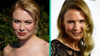 What Did Renee Zellweger Do to Her Face Plastic Surgeon Weighs In [upl. by Ardnuasal770]