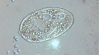 Egzocytoza  Exocytosis orzęsek [upl. by Acsehcnarf]